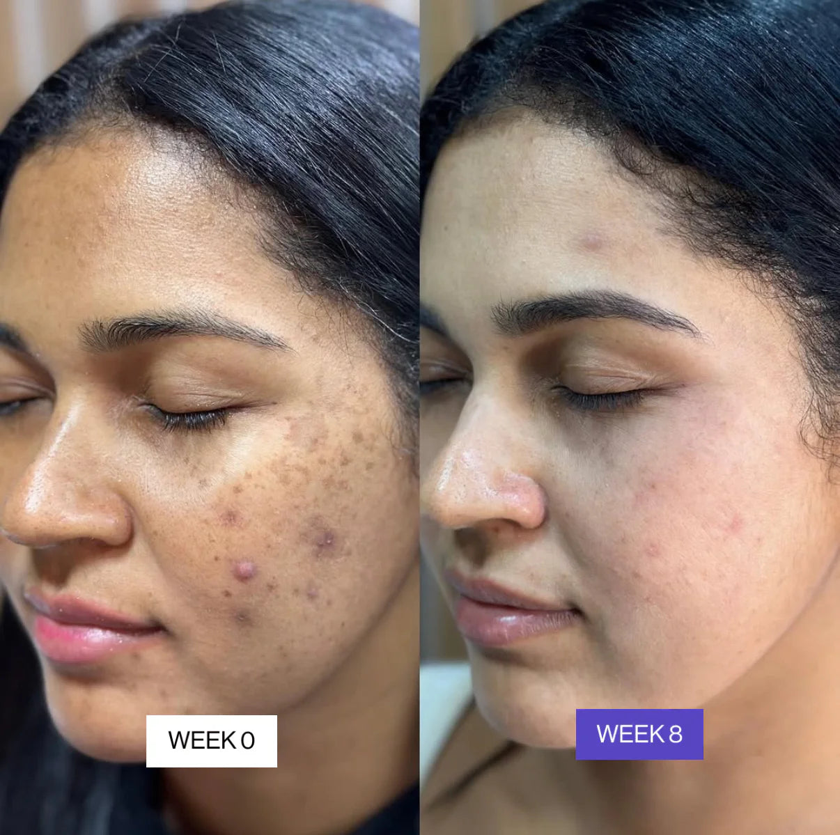 ✨ Glow All Day ☀️ & Repair All Night 🌙 — With Glowry Day & Night Cream Combo 💖