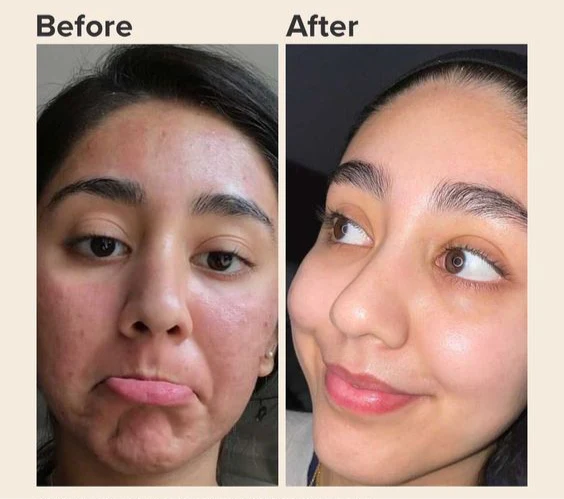 ✨ Glow All Day ☀️ & Repair All Night 🌙 — With Glowry Day & Night Cream Combo 💖