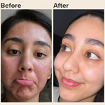 ✨ Glow All Day ☀️ & Repair All Night 🌙 — With Glowry Day & Night Cream Combo 💖