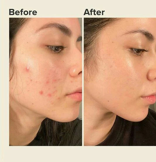 ✨ Glow All Day ☀️ & Repair All Night 🌙 — With Glowry Day & Night Cream Combo 💖